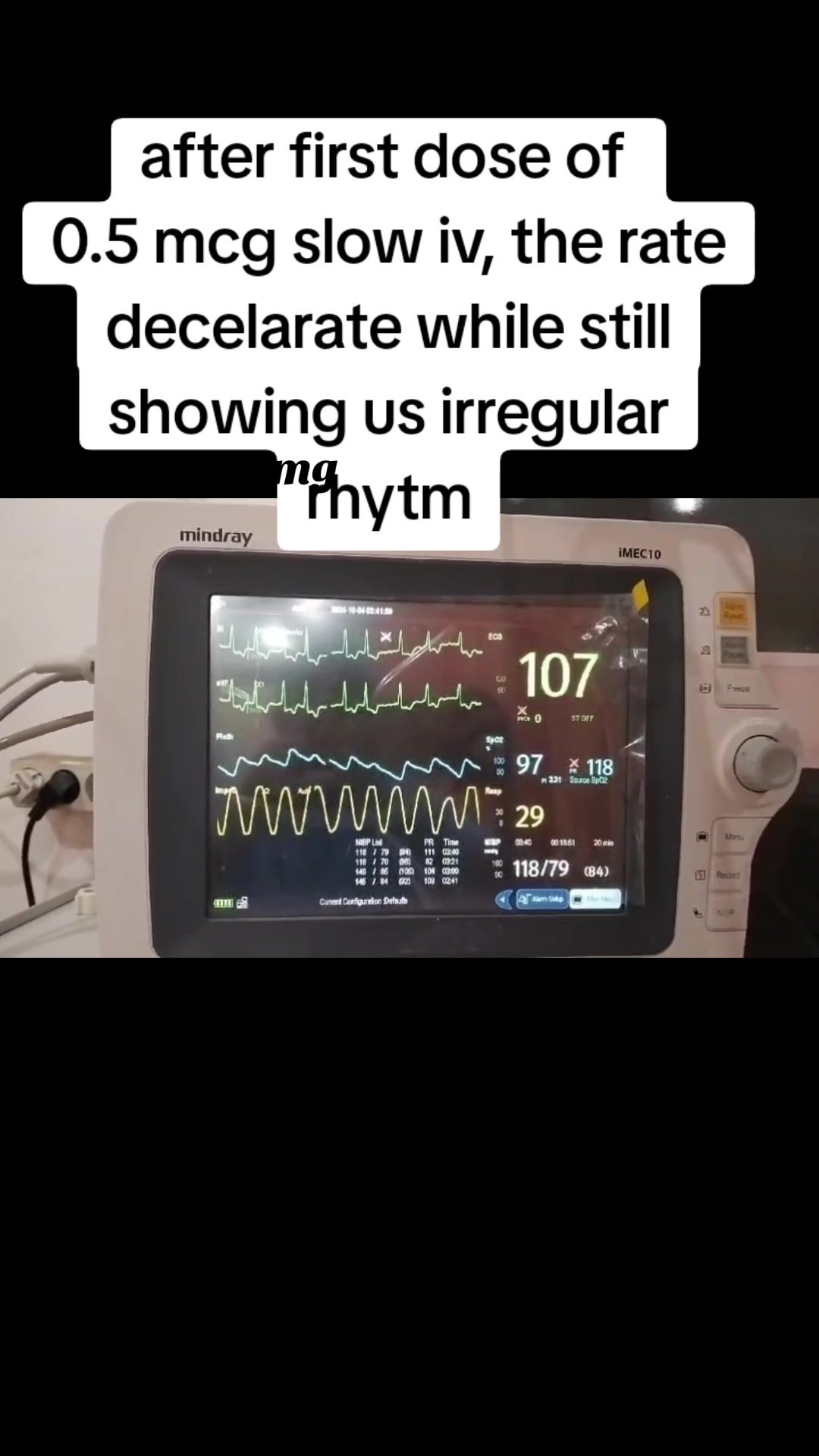 @Erlan A.P, MD