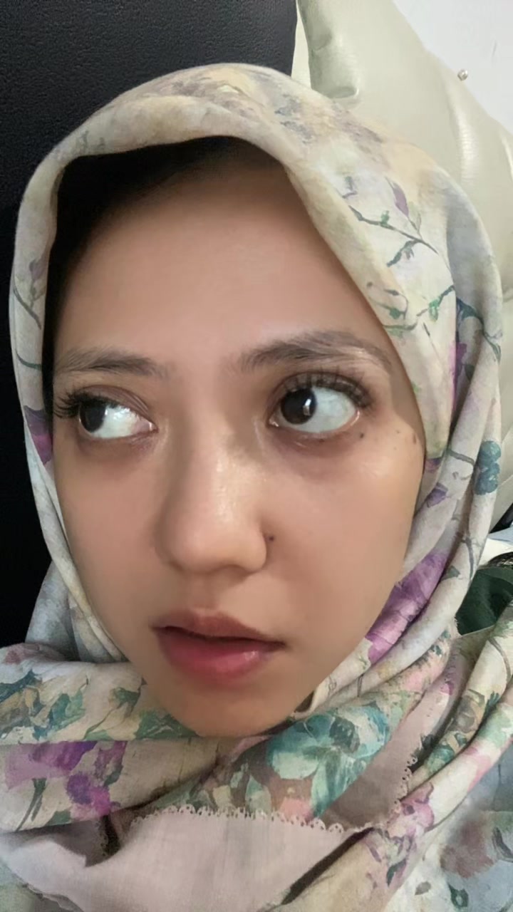 @🙈