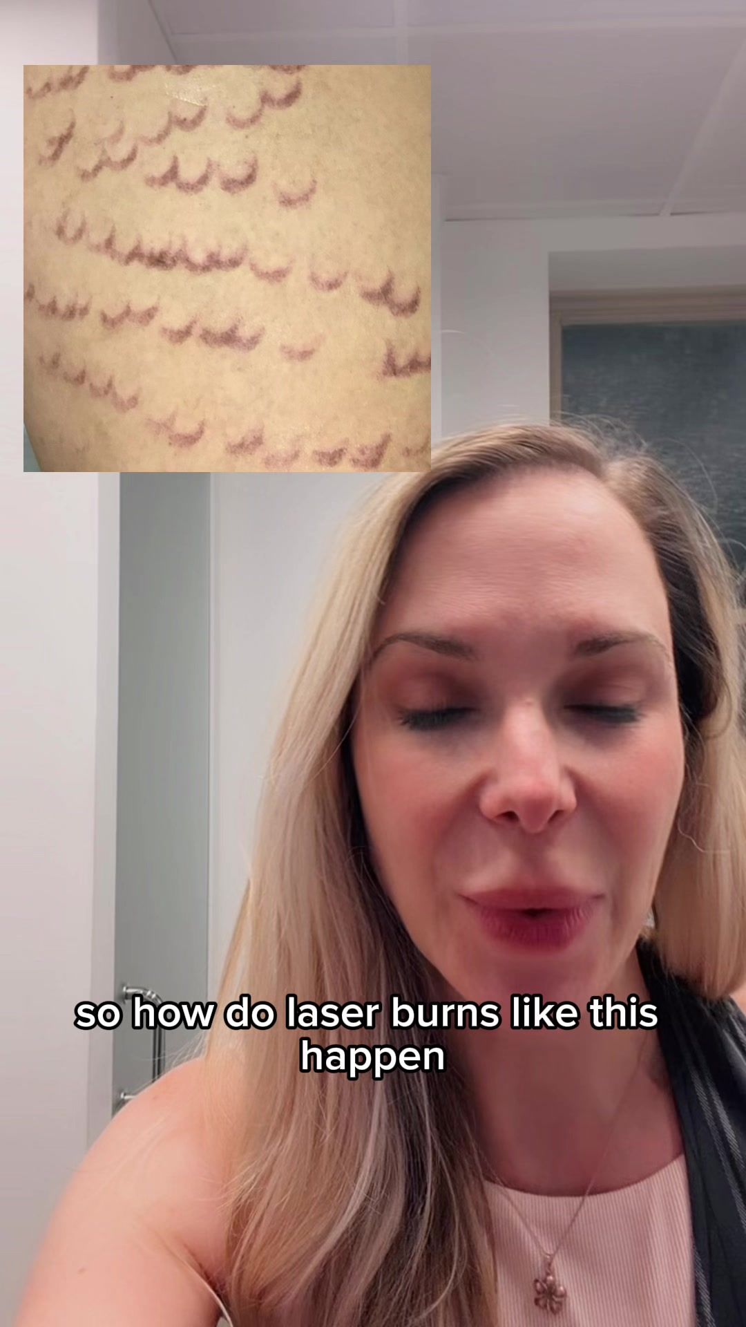 @Rosedermnyc
