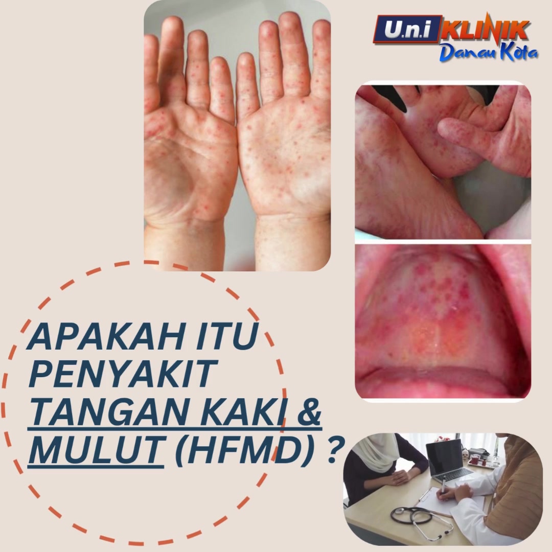 @Uniklinikdanaukota