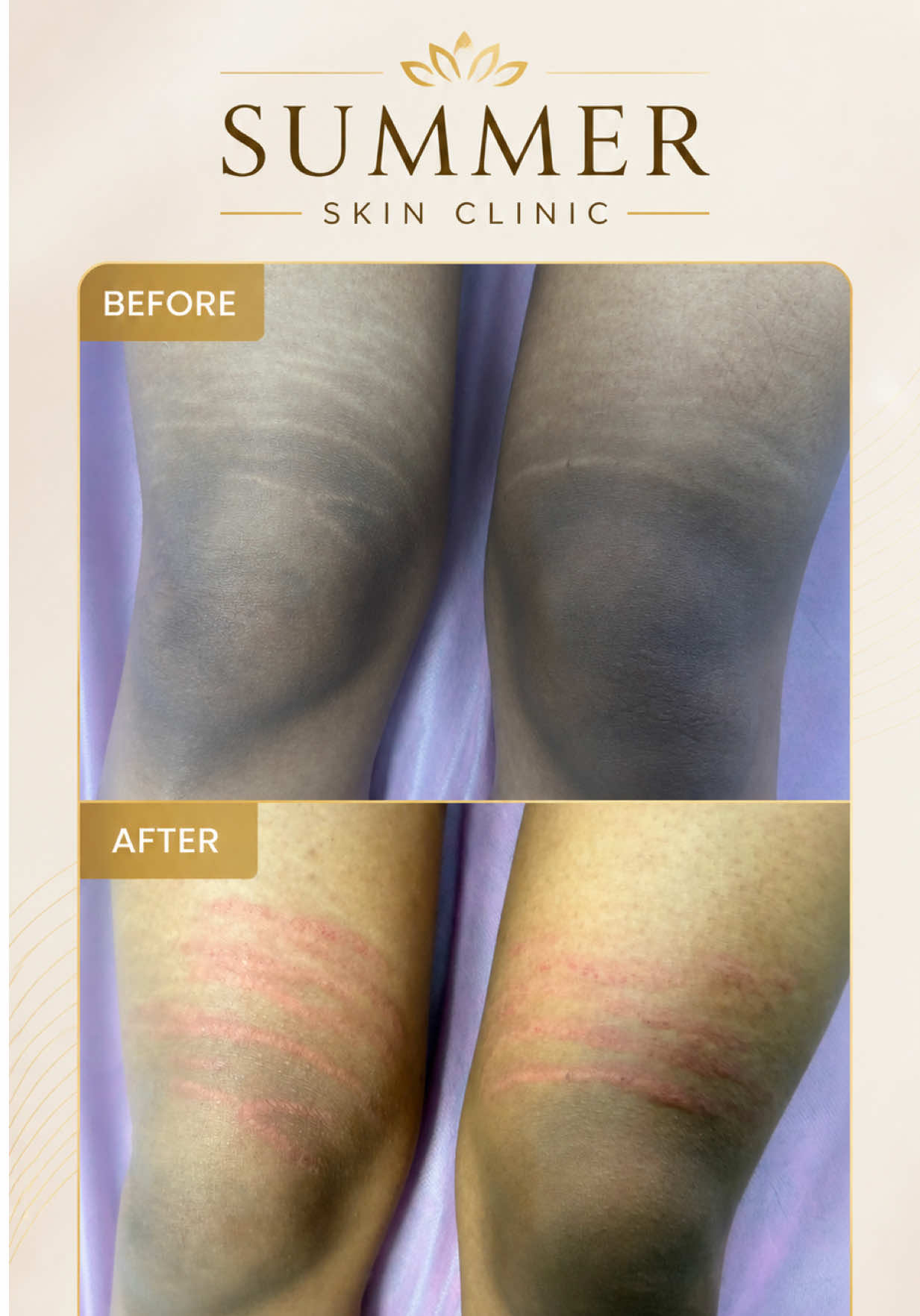 @Summer Skin Clinic | Toronto