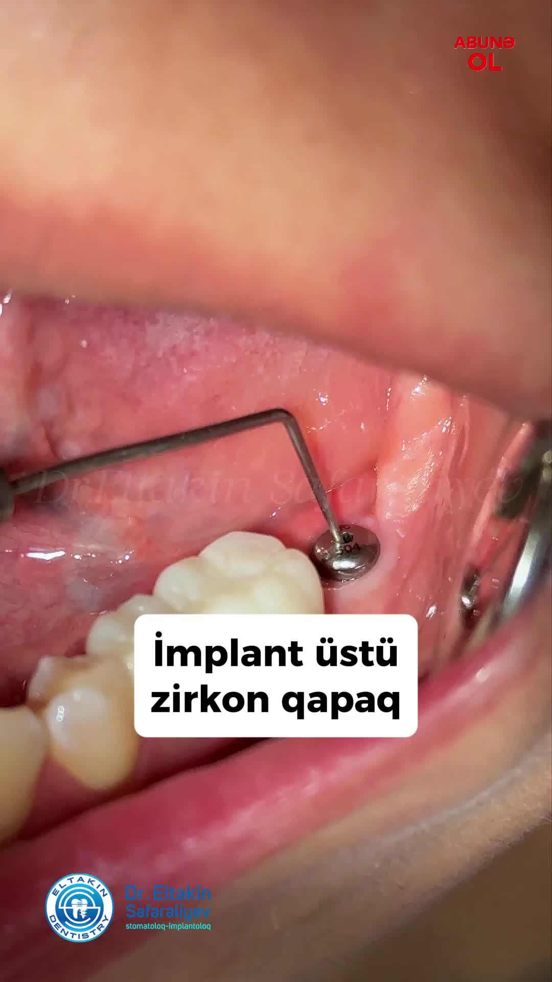 @eltakindentistry