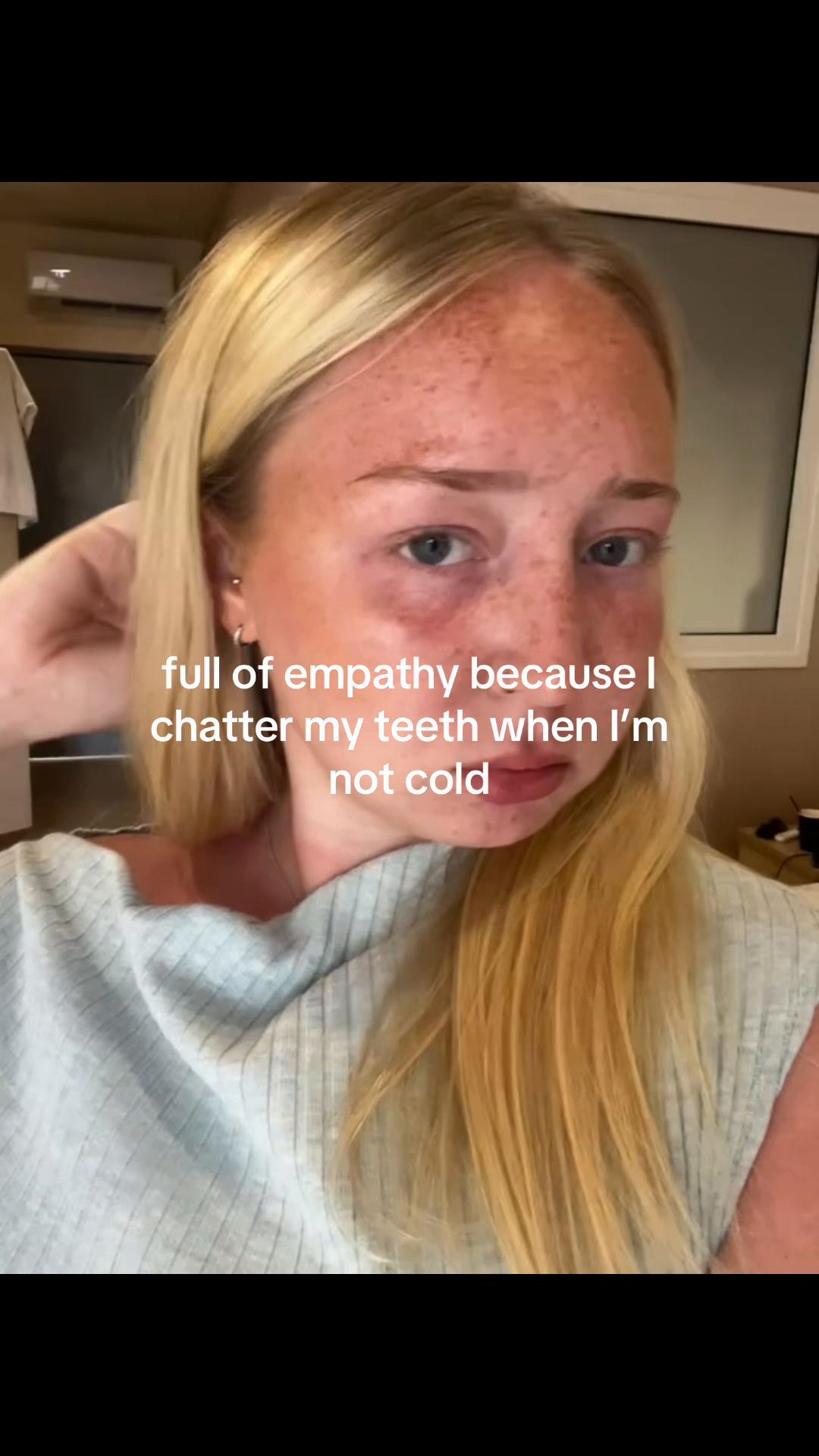 @Scarl
