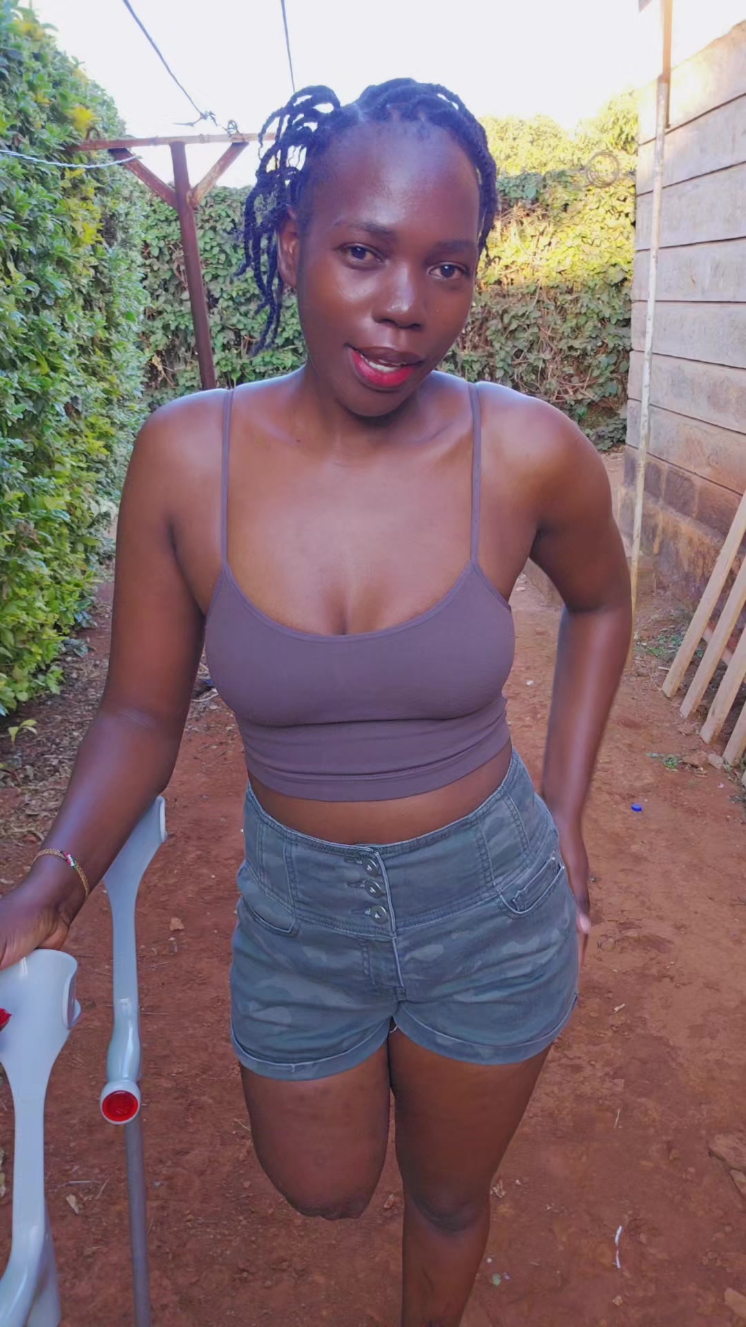 @💎Nattie Amputee🇰🇪♊️