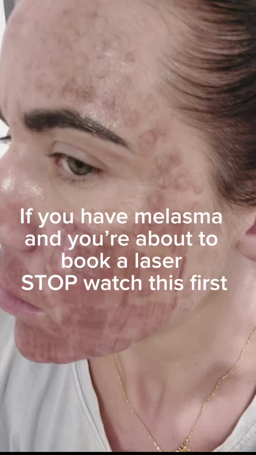 @Skin Consult