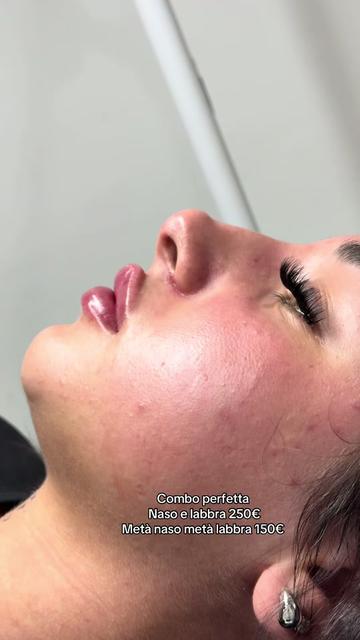 @Rosa.medical.cosmetic💉💕