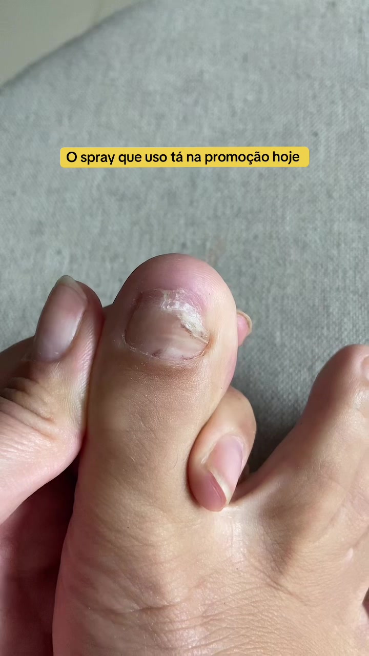 @Carolinaindica