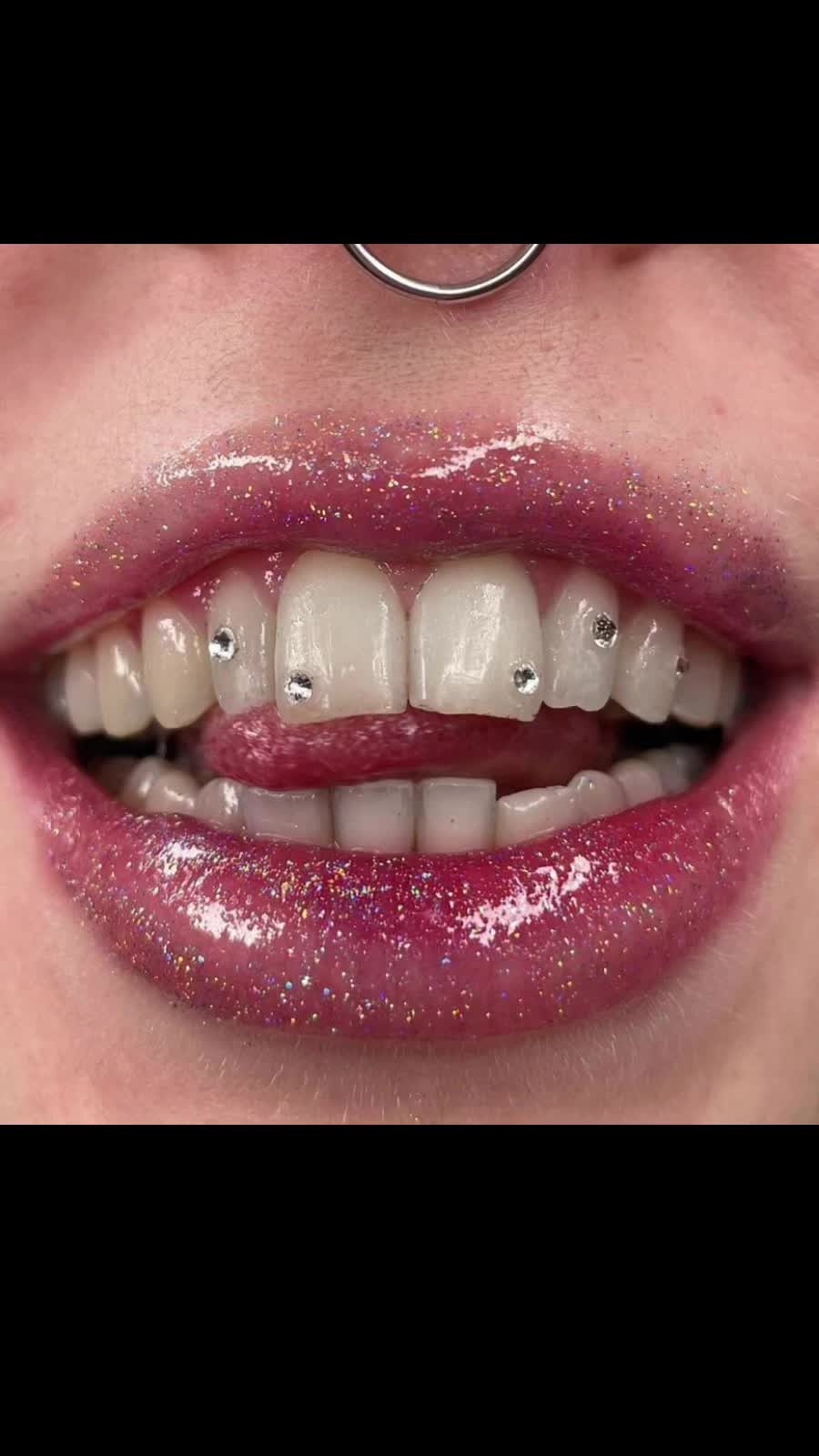 @Zahnschmuck_