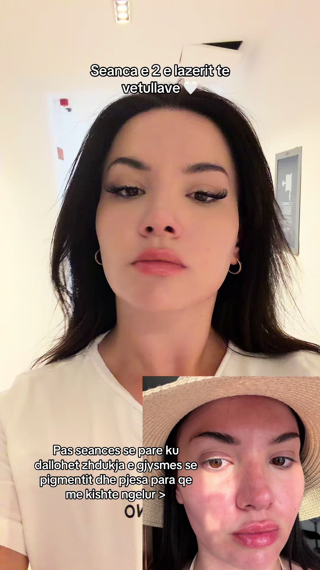 @Gcani