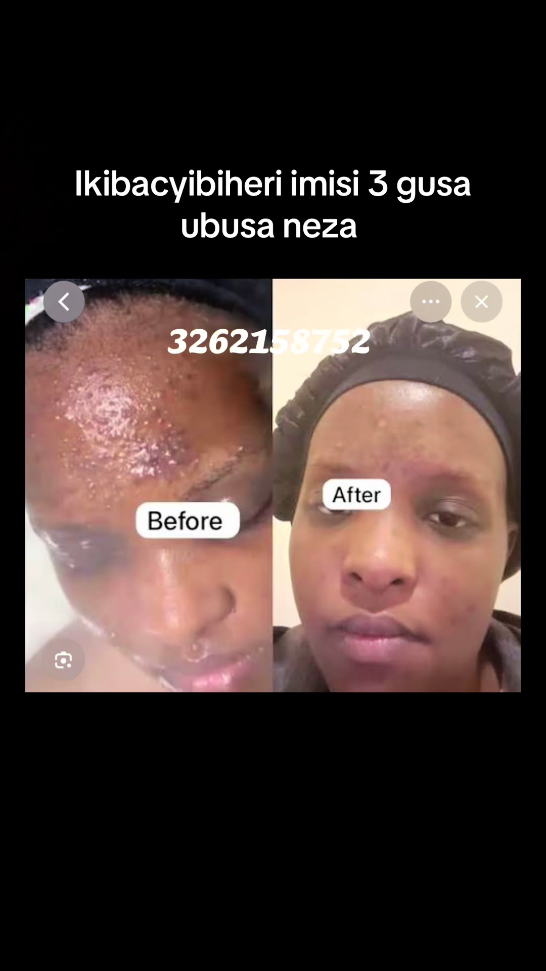 @Muganga marynaturalherbs