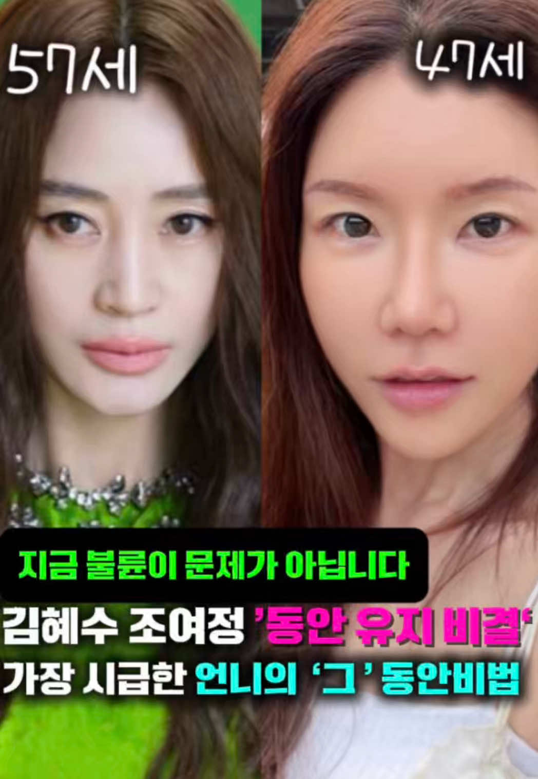 @지나스 GINAS