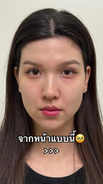 @APEXYOUNGCLINIC
