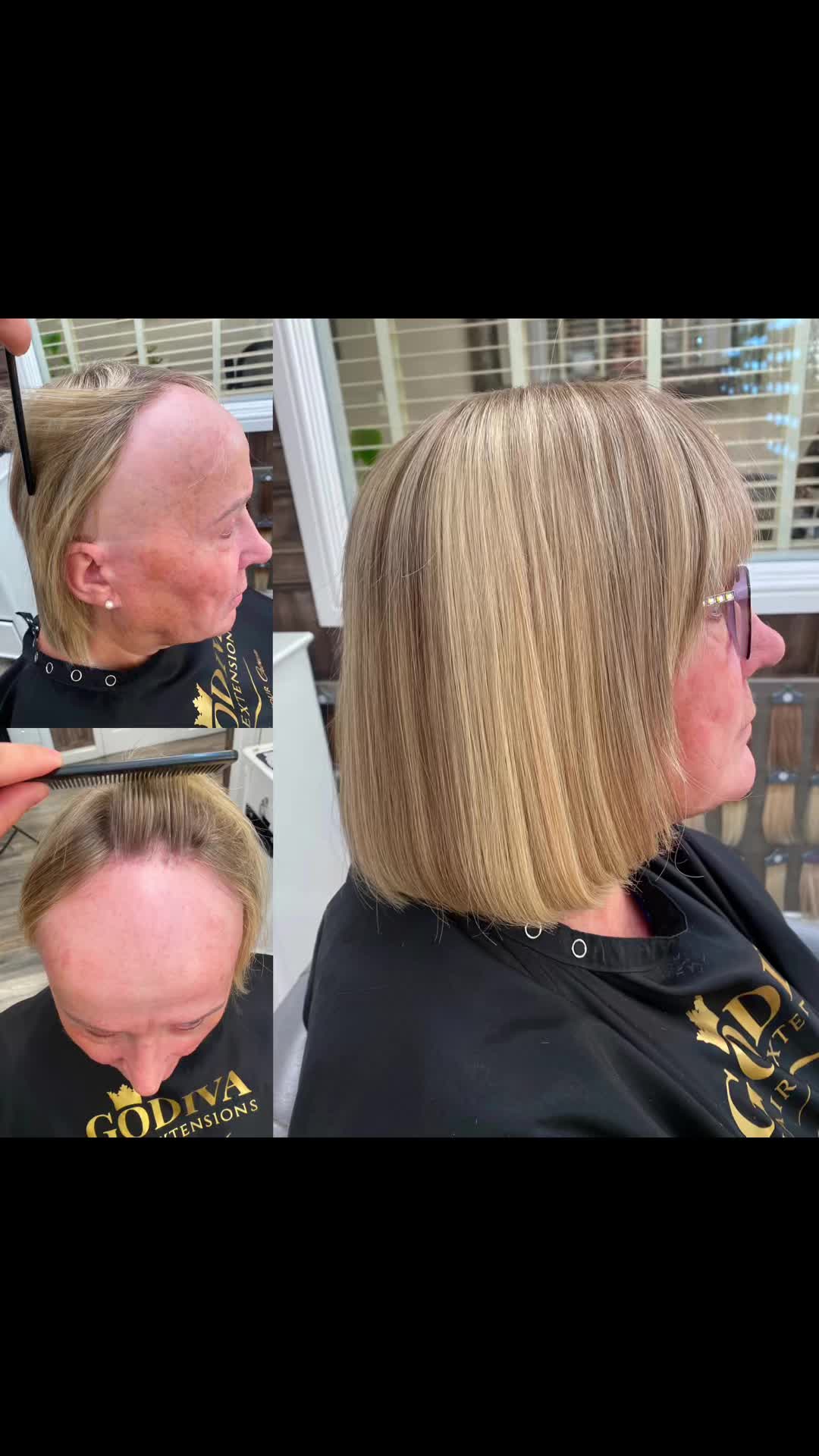 @Godiva Hair Loss Specialists