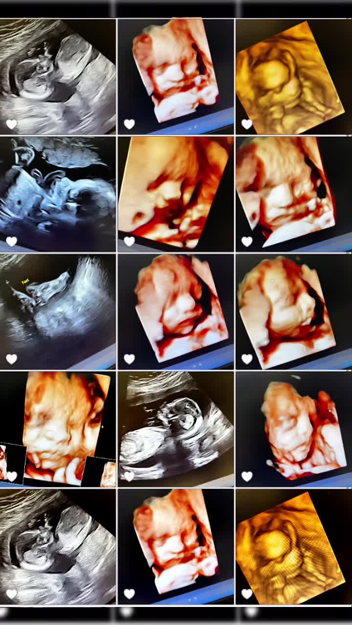 @WindowToTheWomb Ellesmere Port