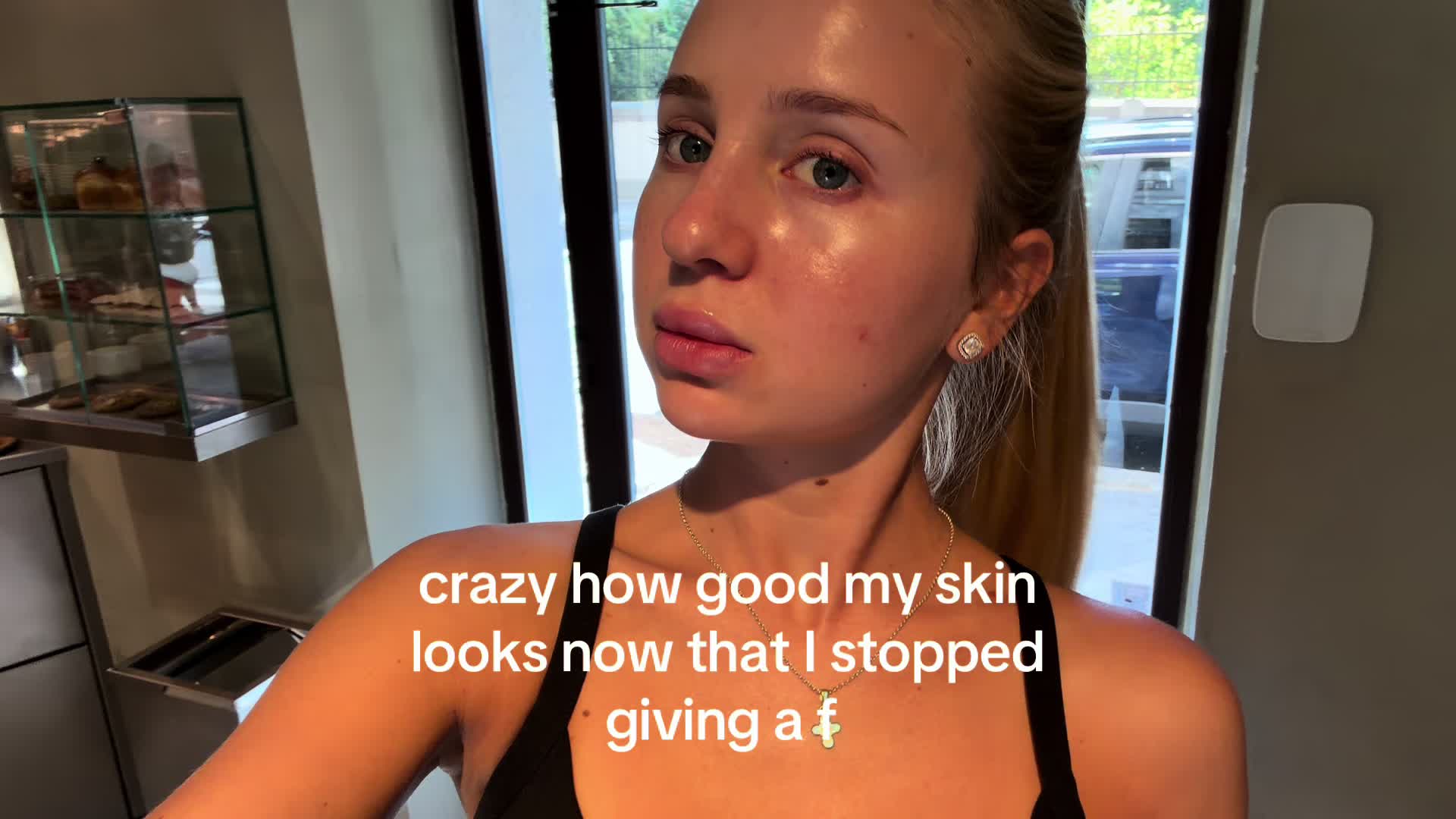 @aurora
