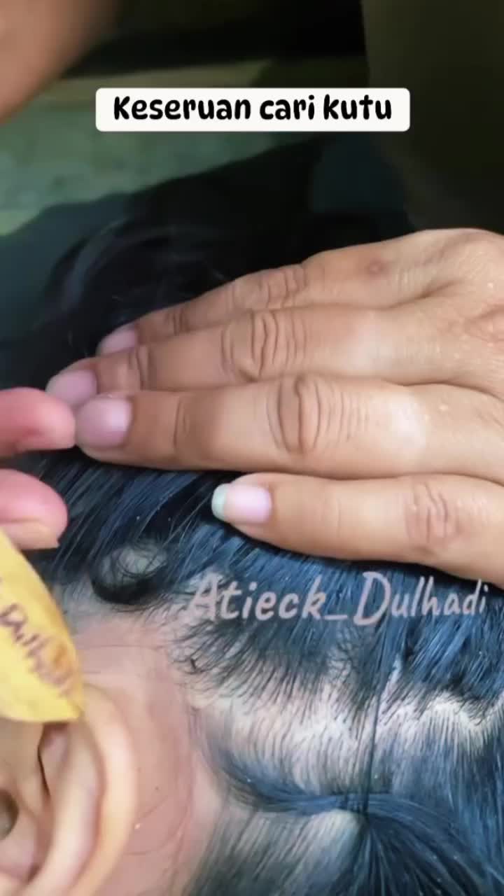 @Atieck dulhadi 🪲💇