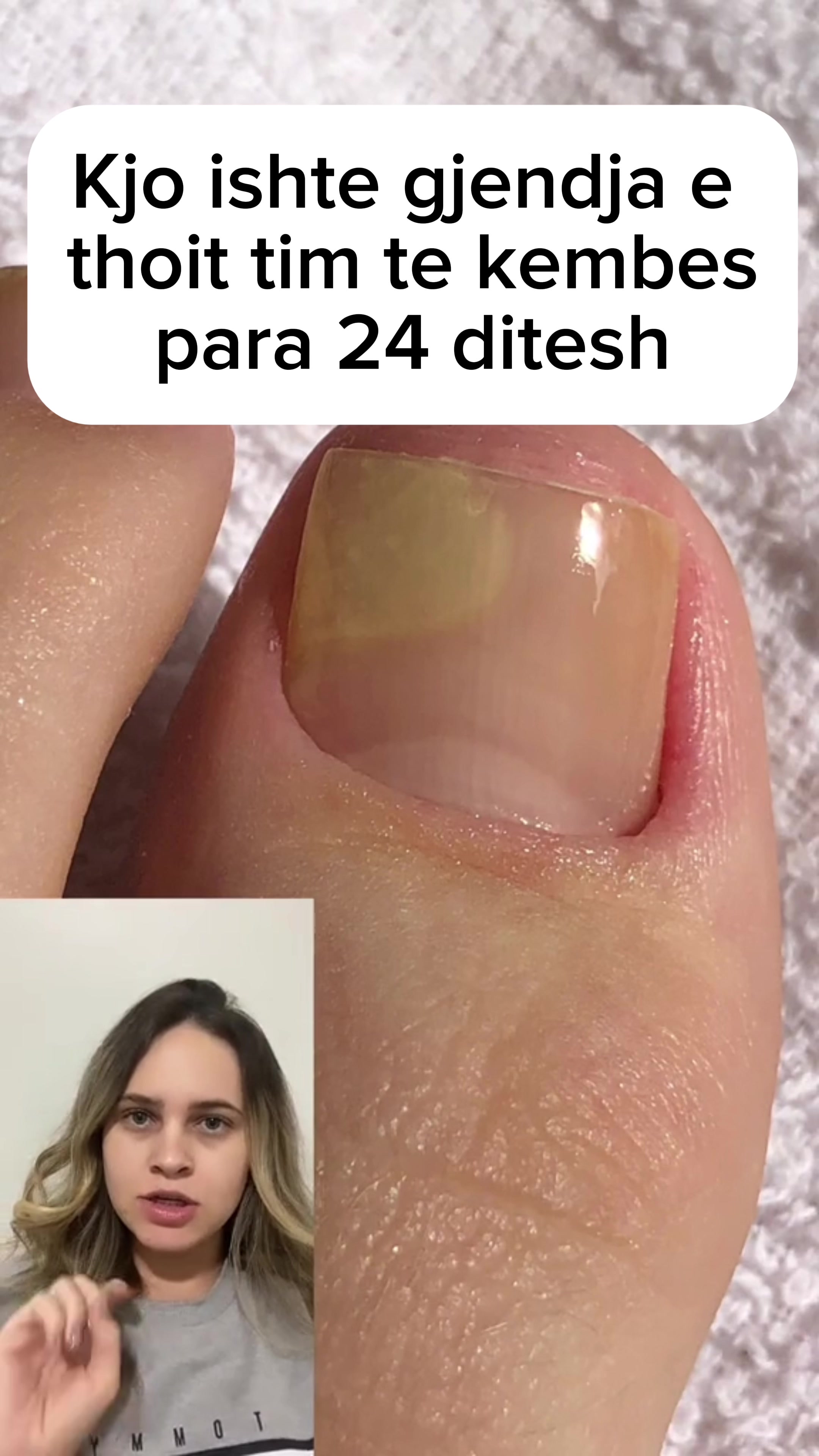 @Lumar