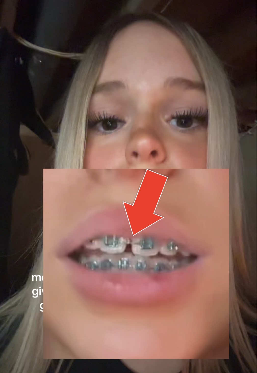 @The Braces Guy