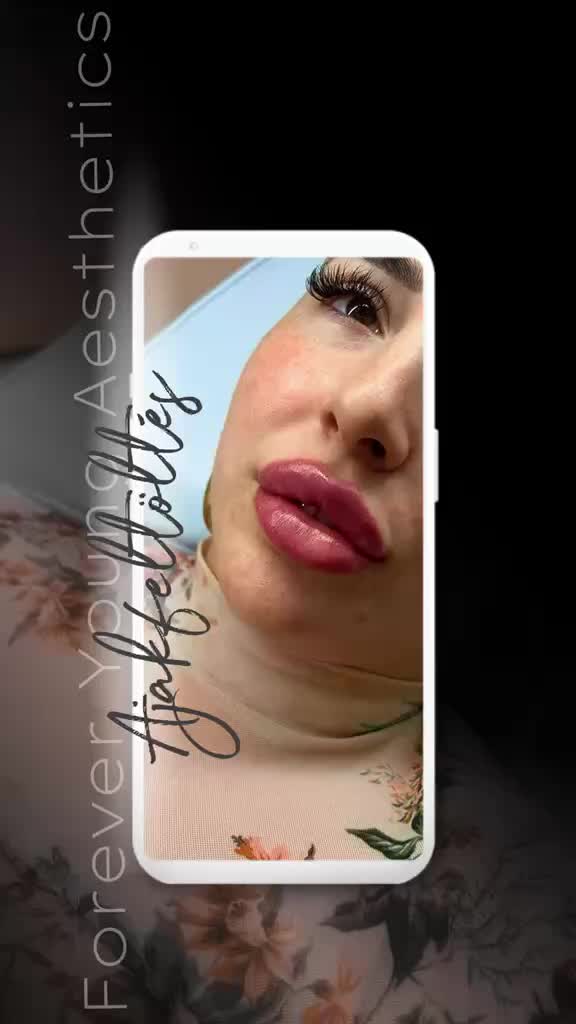 @odettoszko