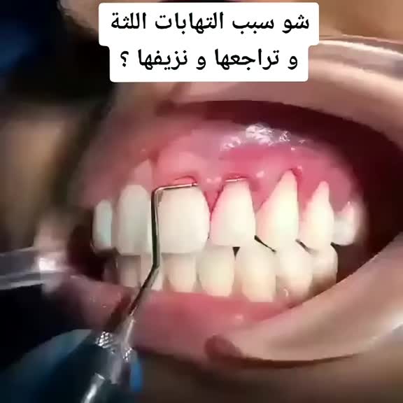 @Samer Akkad | Tandl&auml;kare