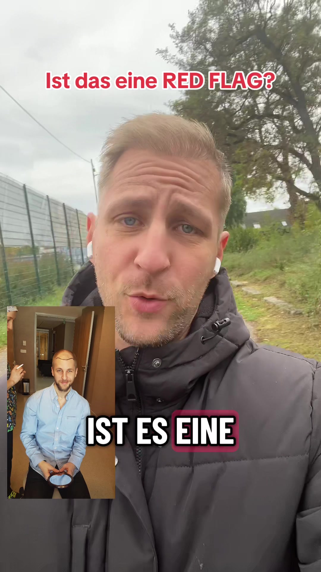 @Mr. Hairtransplant