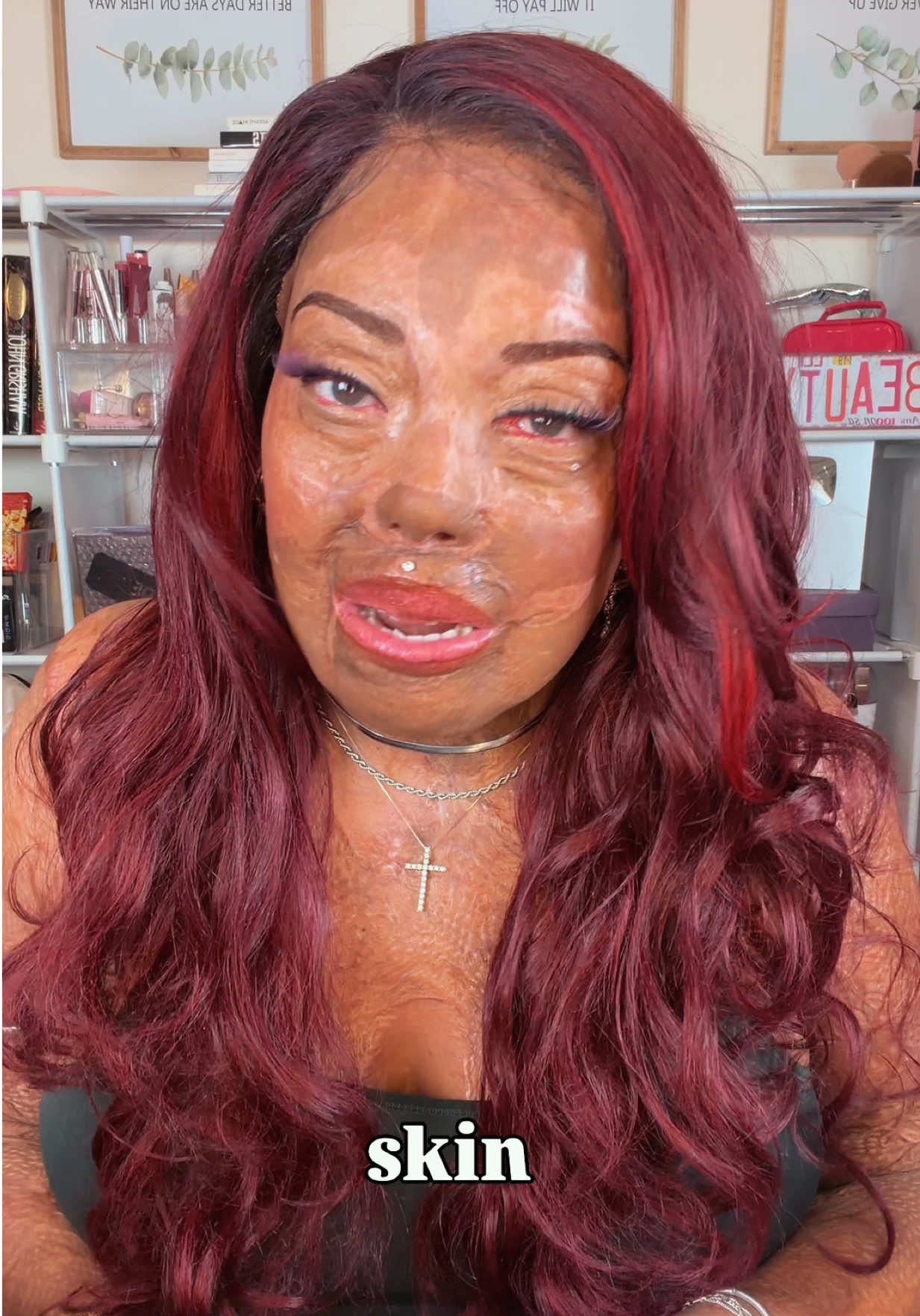 @Burned Beauty 2018&reg;️