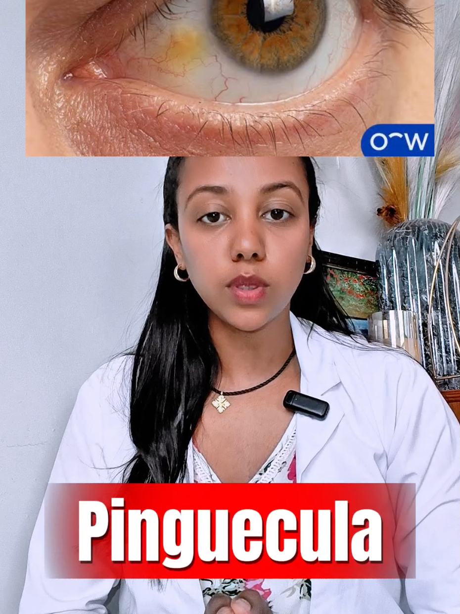 @Dr Wengelawit(Ophthalmologist)
