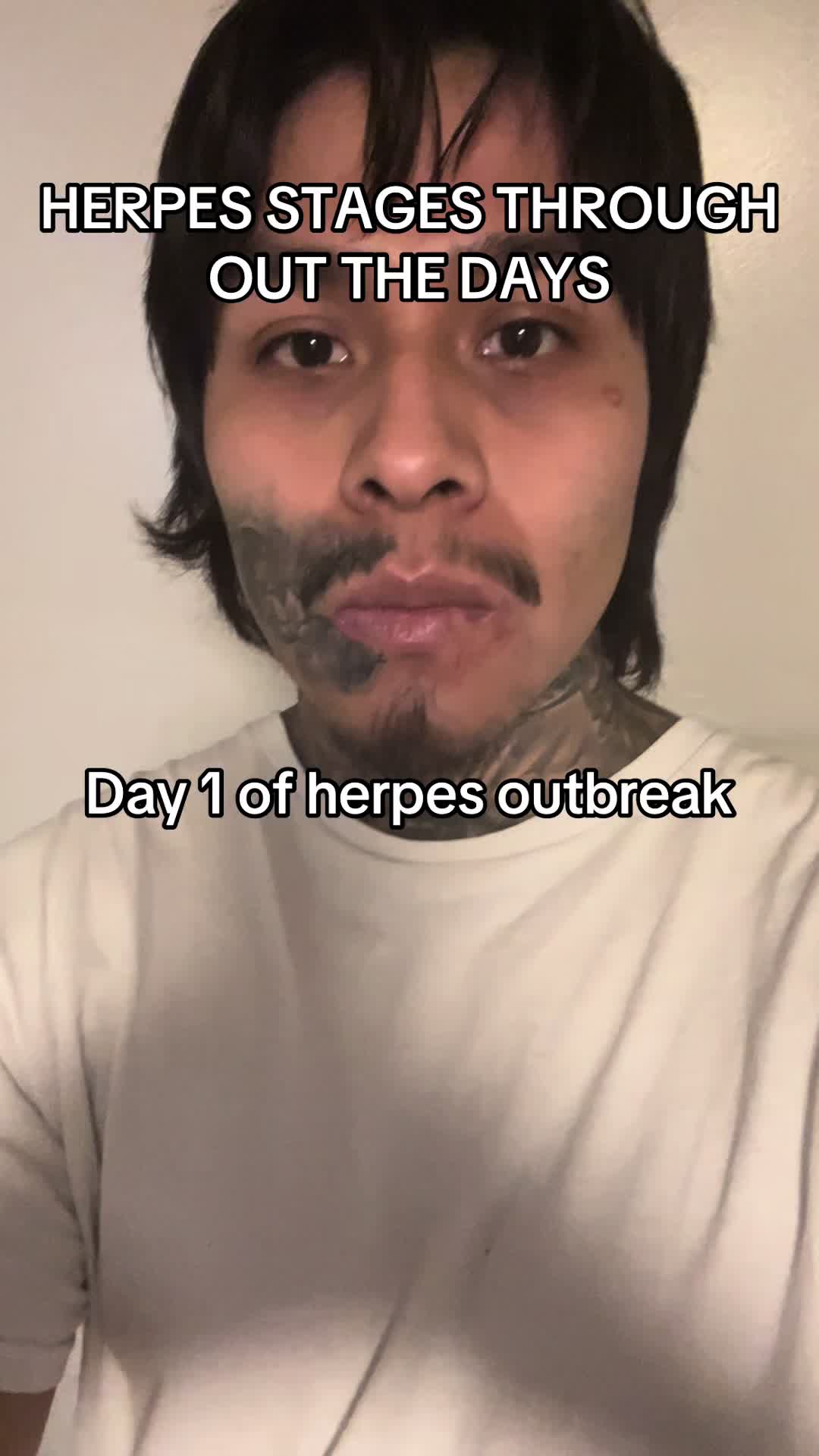 @Marcos