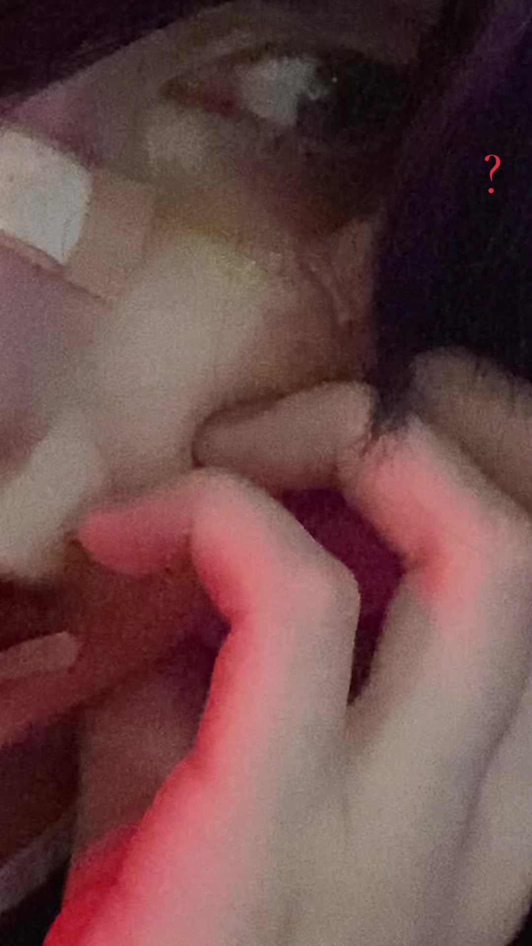 @1581