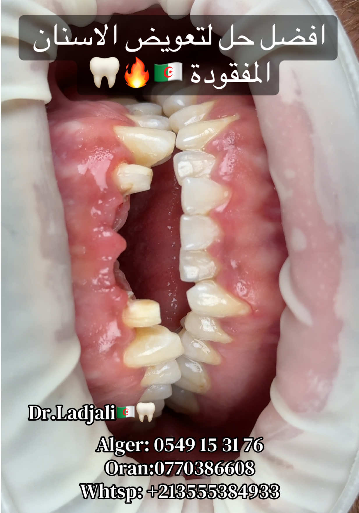 @Dr.ladjali