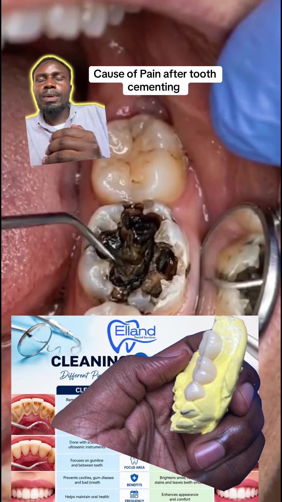 @Dr~MUJUNI 🦷🇺🇬✅