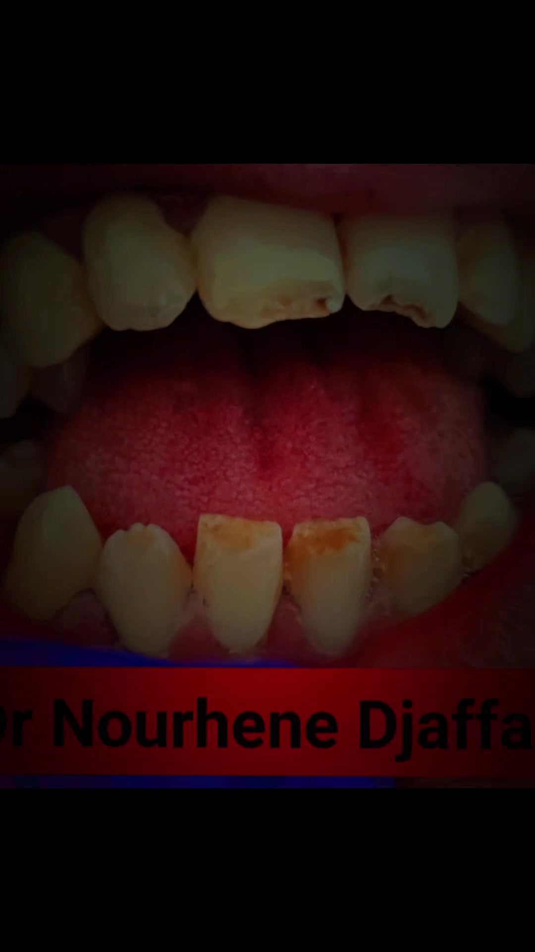 @Dr Nourhene Djaffali