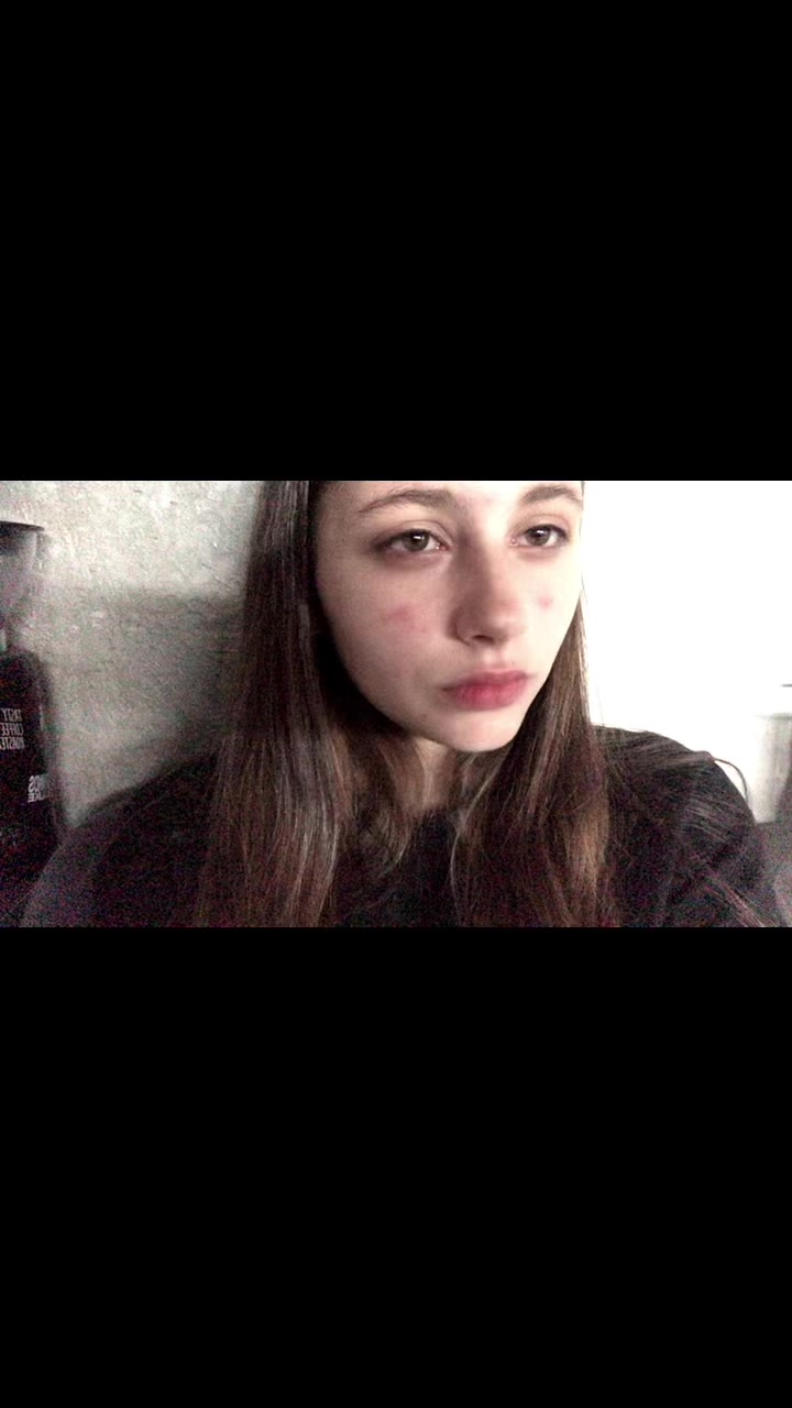 @Линка
