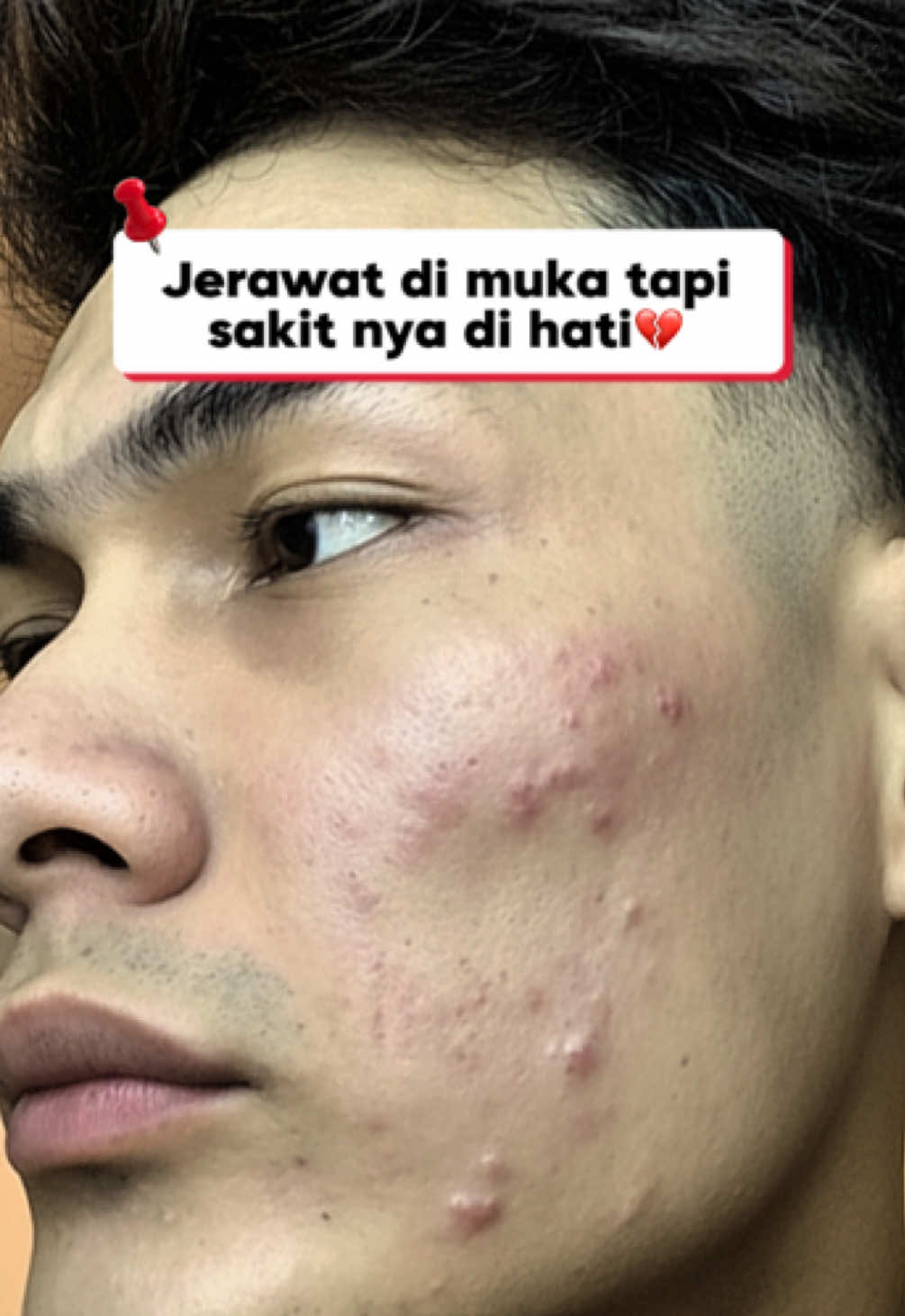 @Saka Syarif