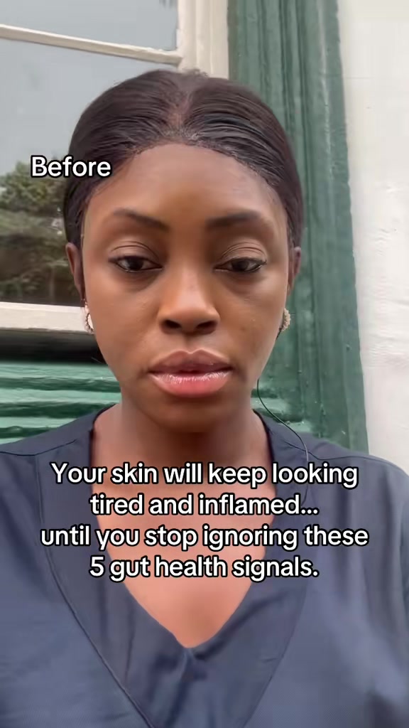 @IYALIM