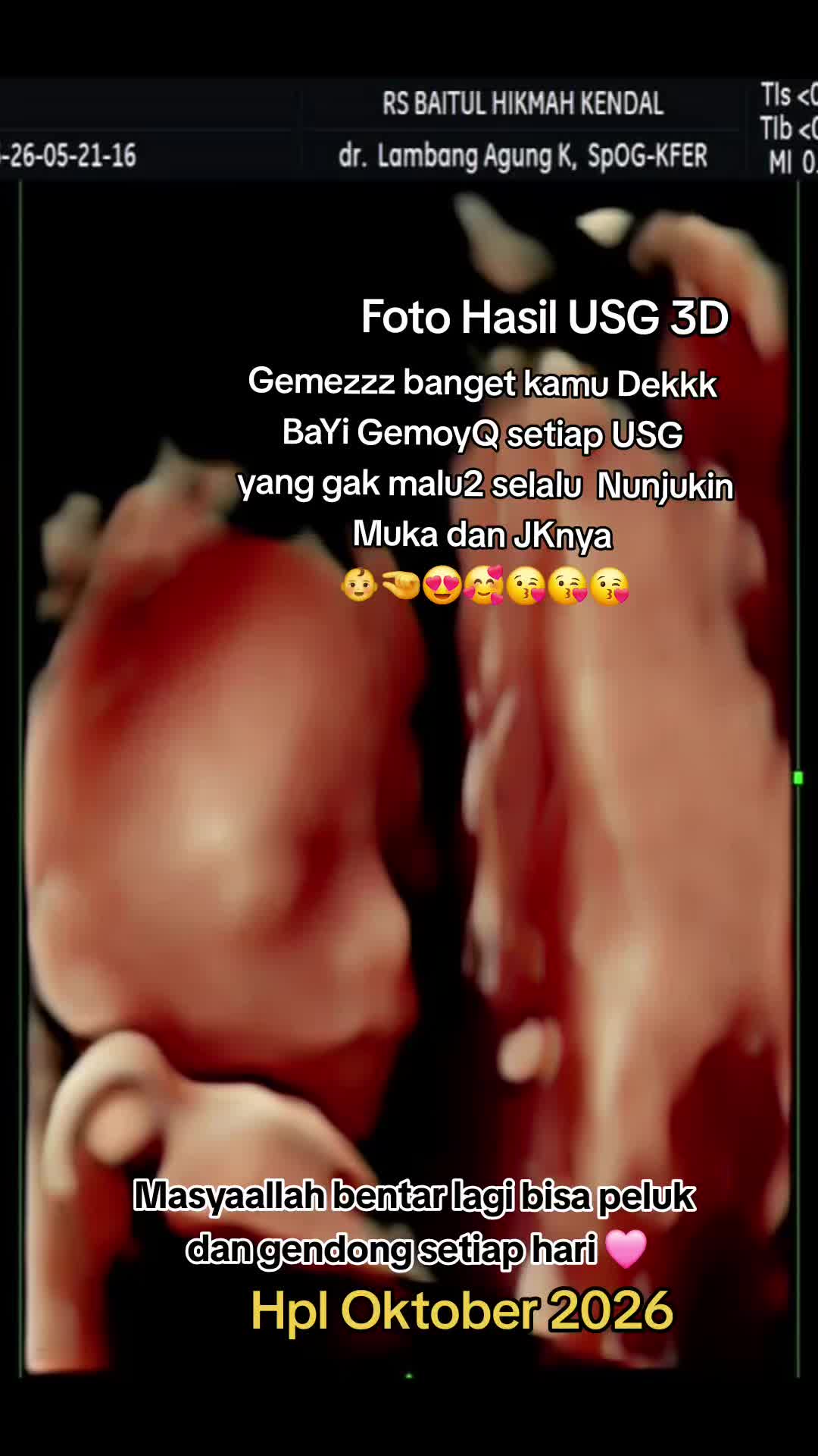 @Afa_Fajriyah🍁