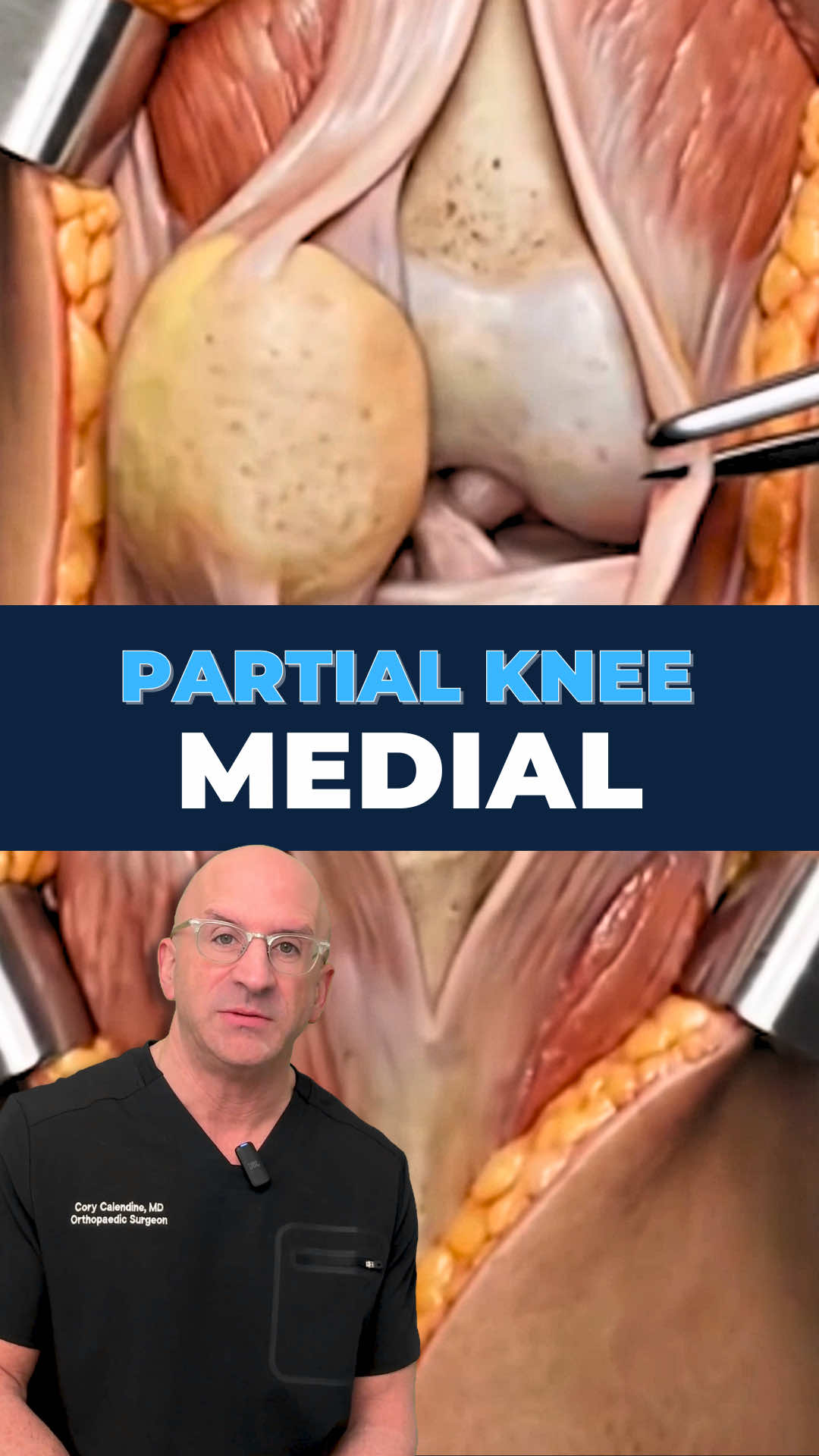 @Bone Doctor - Joint Pain MD