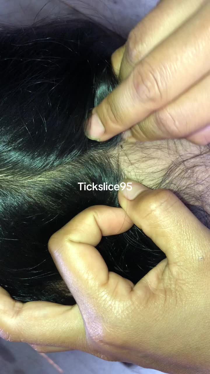 @Tickslice95