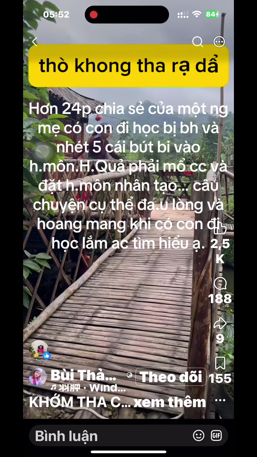 @Hoa sún ( nhí nhố)