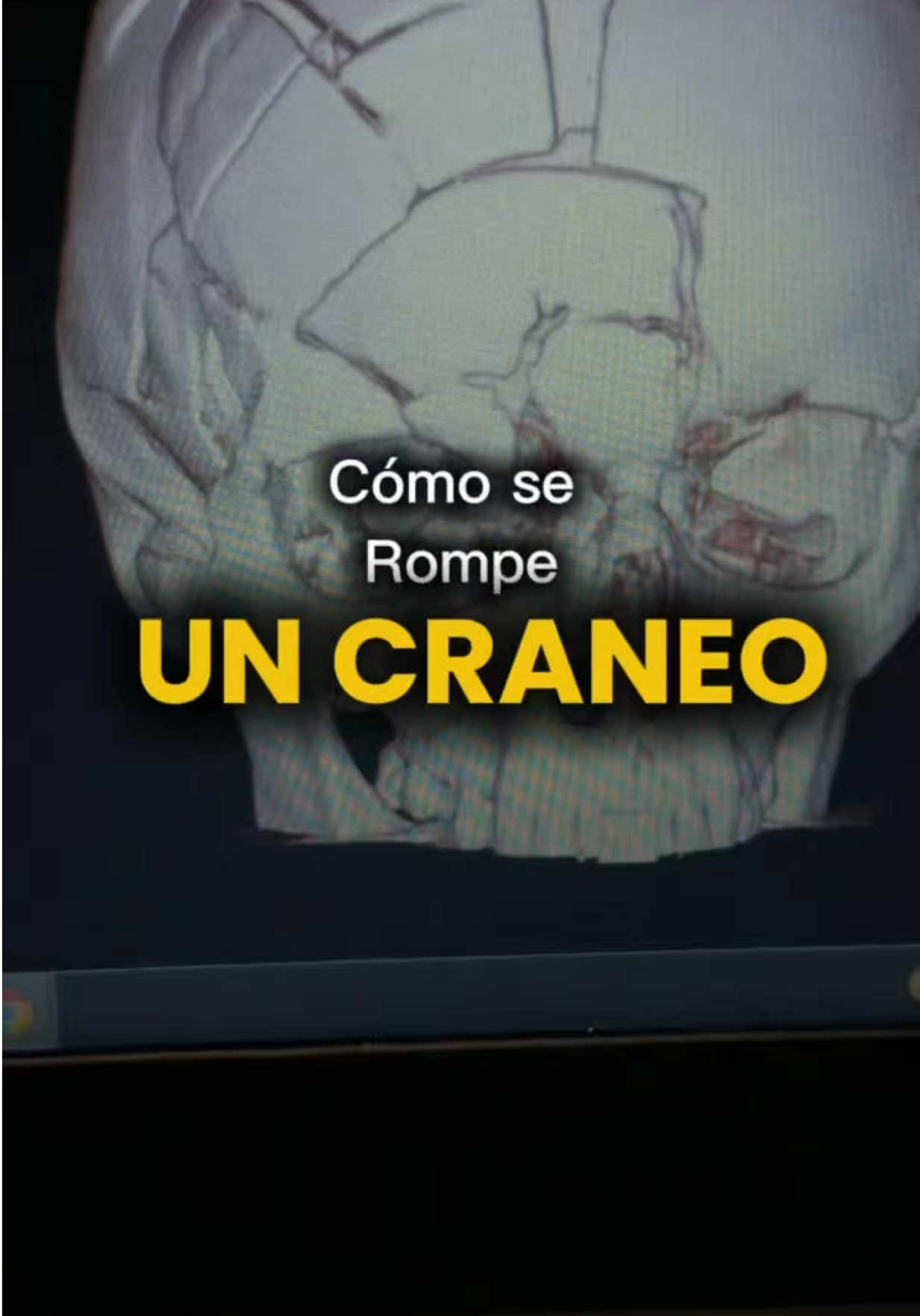 @Richard Su&aacute;rez | Intensivista