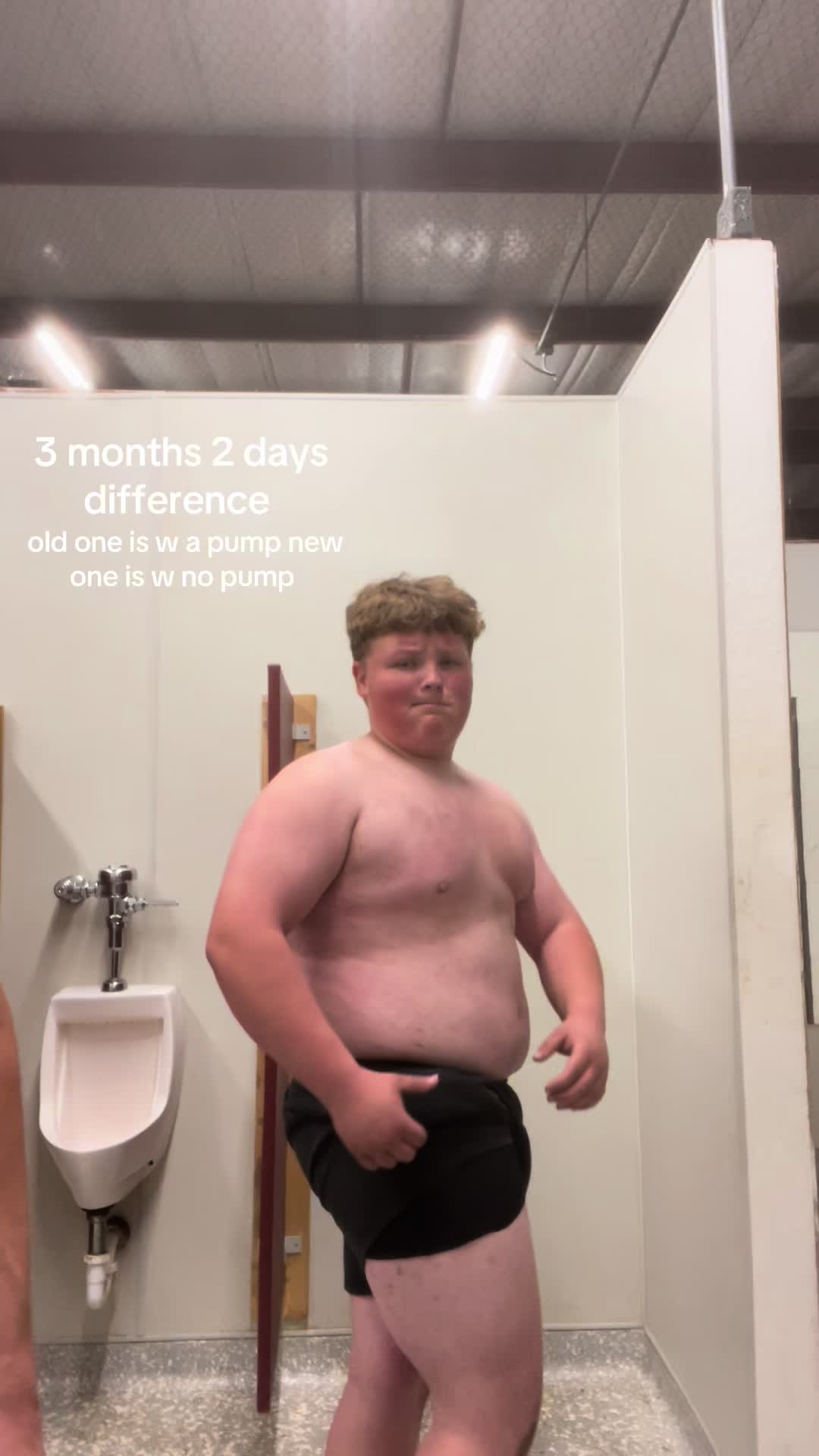 @X_gains