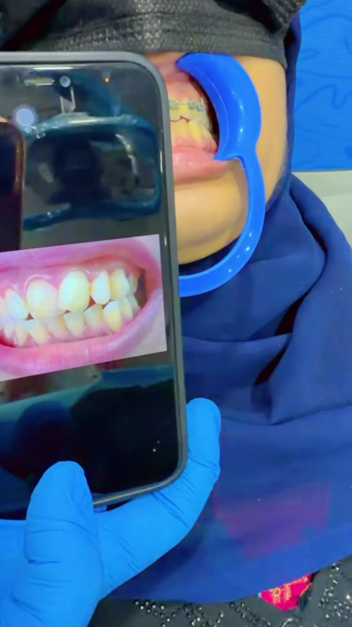 @Dr__Anmoll🦋🦷