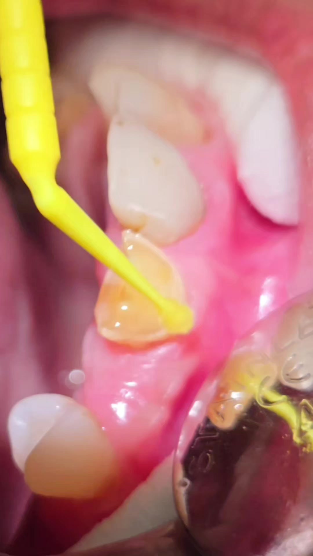 @Catford Dental