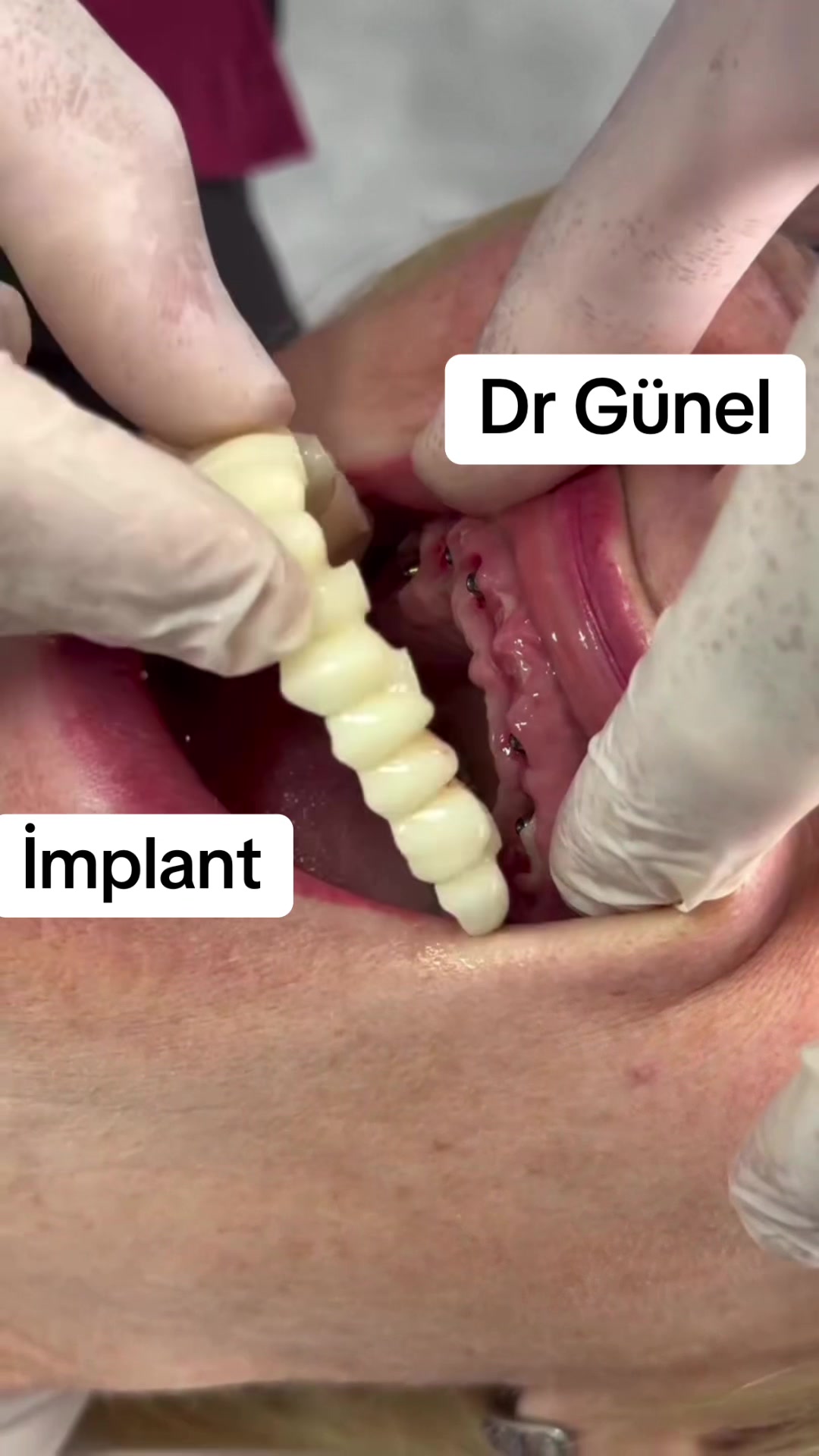 @Dentist_Günel