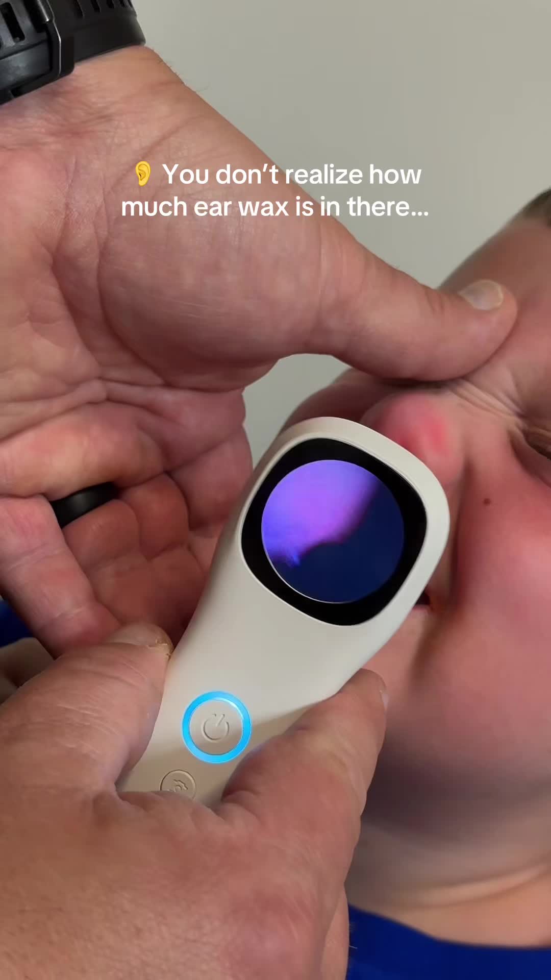 @B_Wins