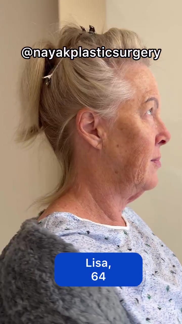 @NayakPlasticSurgery