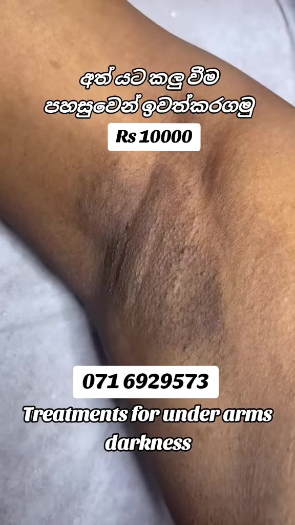 @Beautylogylk