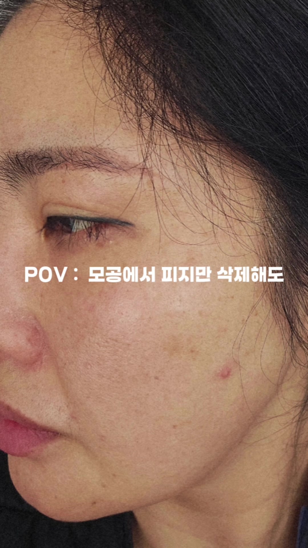@피부굿당 박보살의 피부로 인생역전!