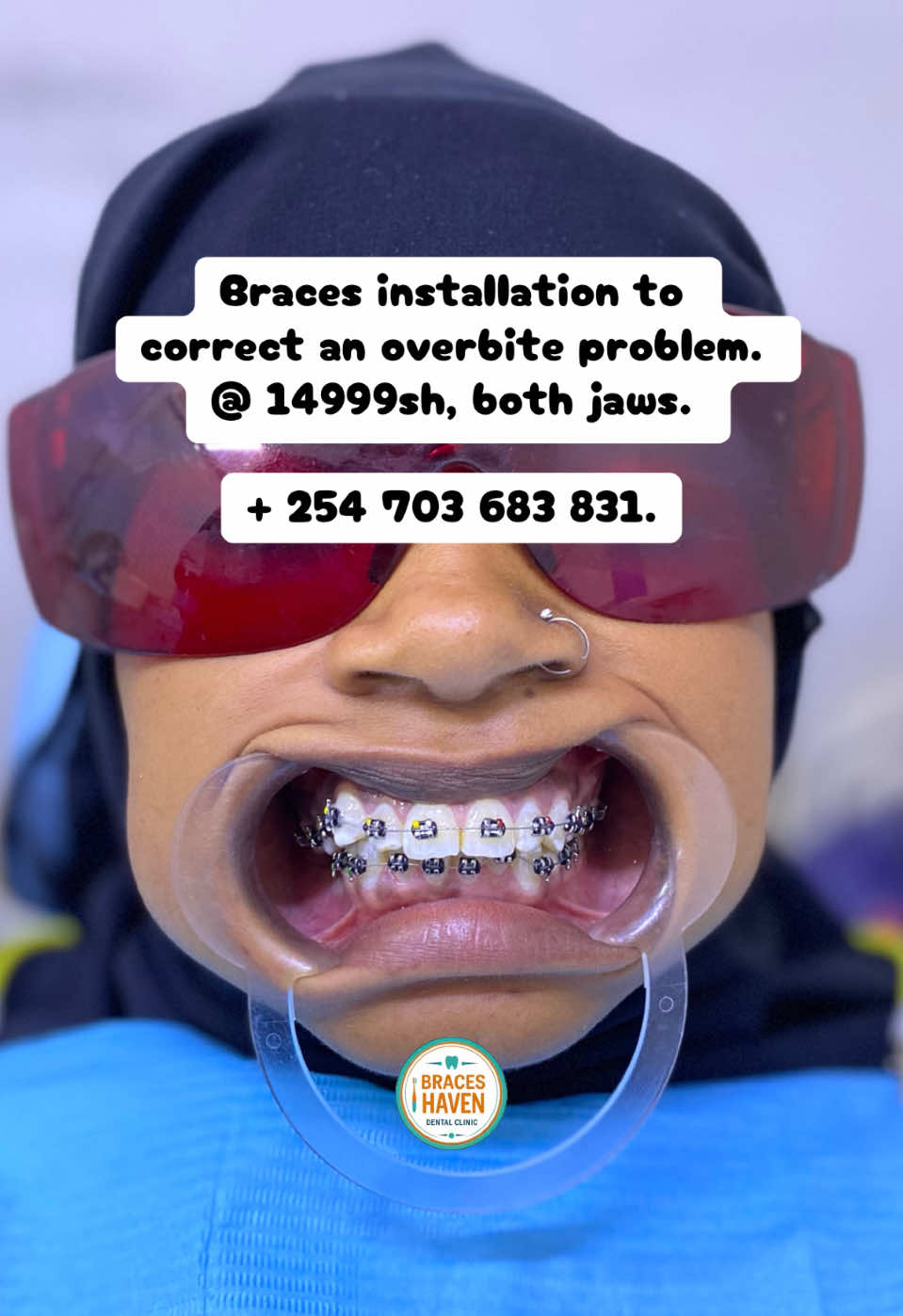 @Braces Haven Nairobi Dental