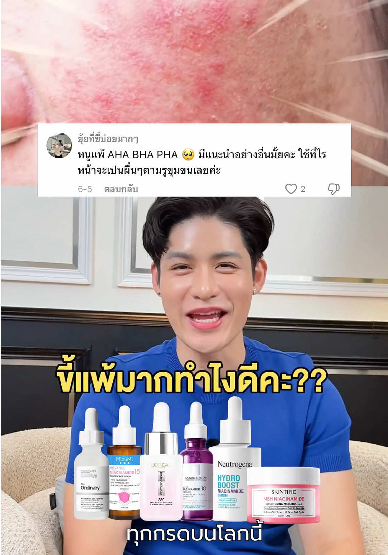 @หนูปอนด์ที่ชอบเลเซ่อร์